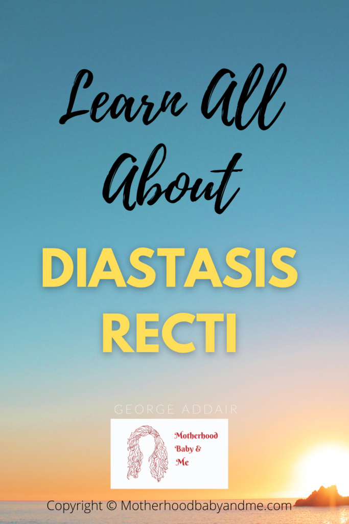 All You Need To Know About Diastasis Recti