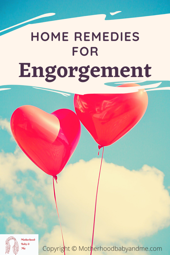 Pinterest pin for this article on engorgement