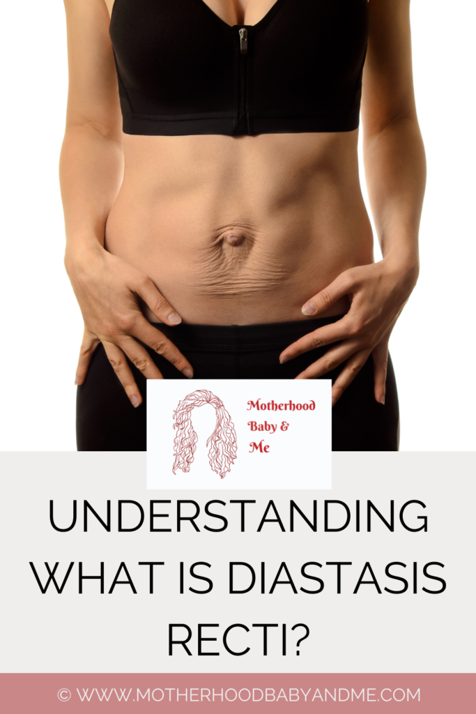 Pinterest pin on understanding what is diastasis recti