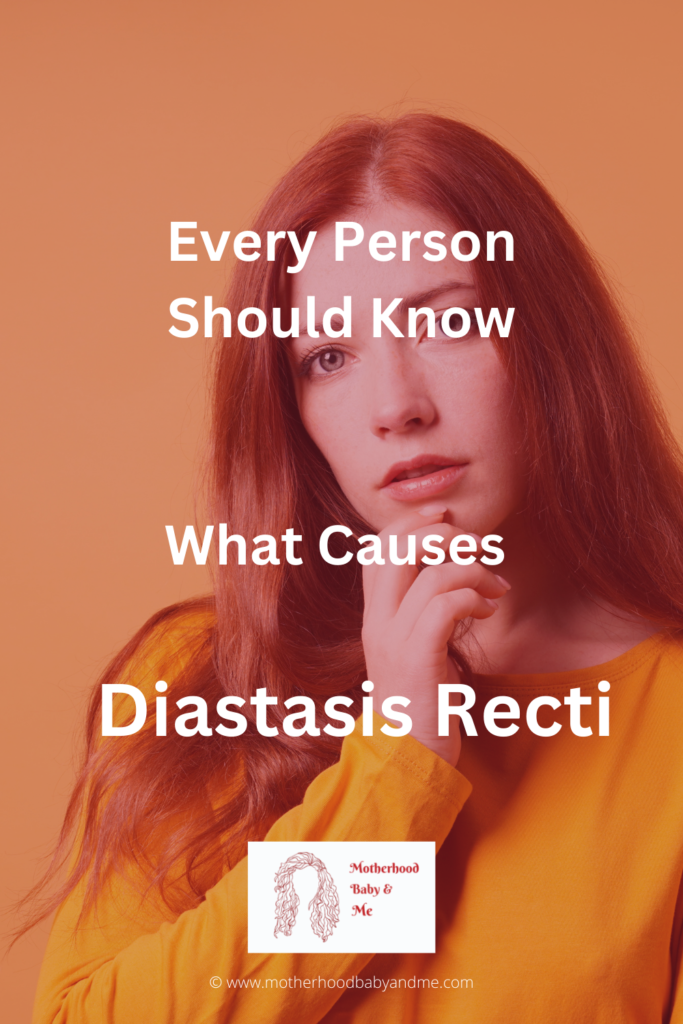 Pinterest Pin for this article What Causes Diastasis Recti?