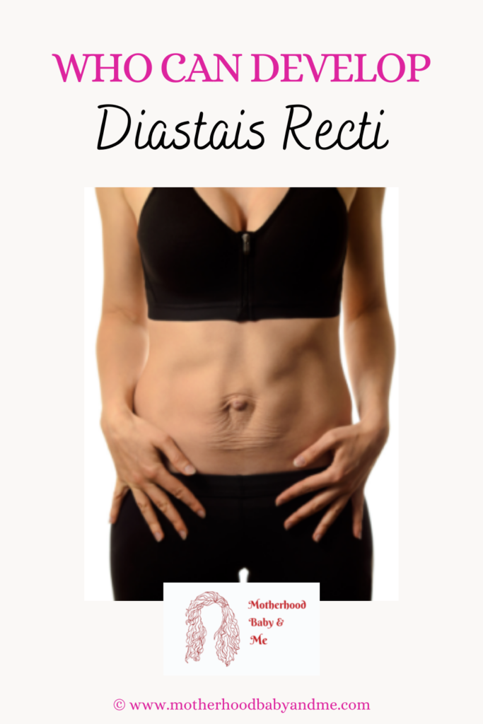 pinterest pin for this article Who Can develop diastasis recti